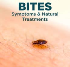 Bed bug bites - Dr. Axe