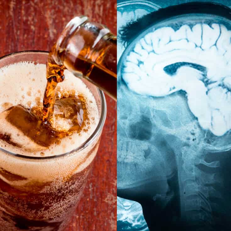 Artificially sweetened drinks increase risk of stroke and dementia - Dr. Axe