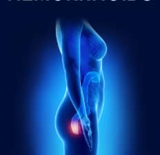 How to get rid of hemorrhoids - Dr. Axe